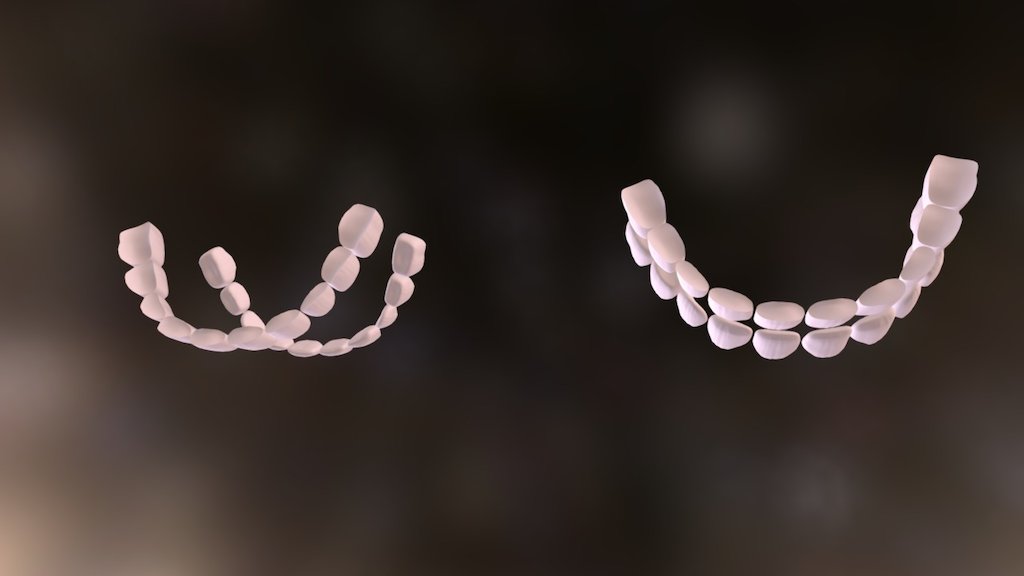 Teeth Small - 3D model by hoangnq [a53cd73] - Sketchfab