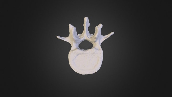L2 vertebral body 3D Model