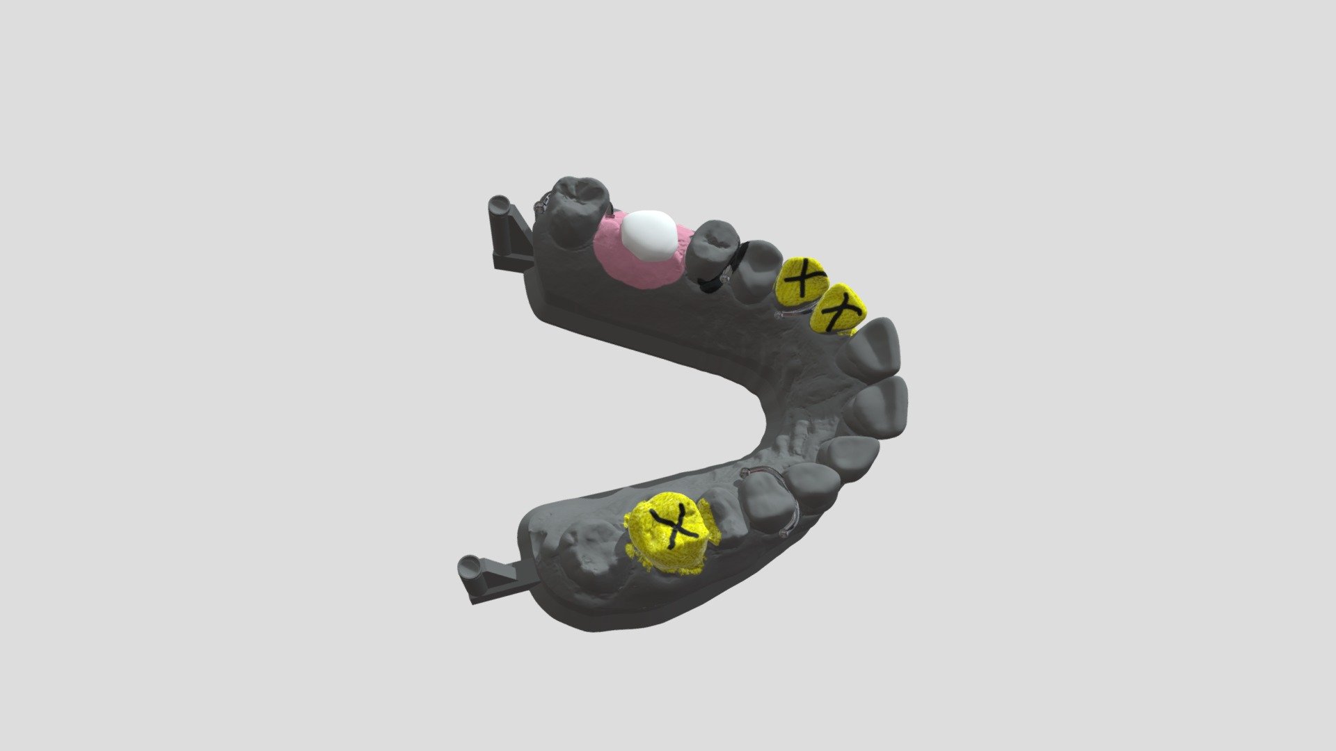 Partial_Denture_Design_stl 3D model by a.lord [a56712b] Sketchfab