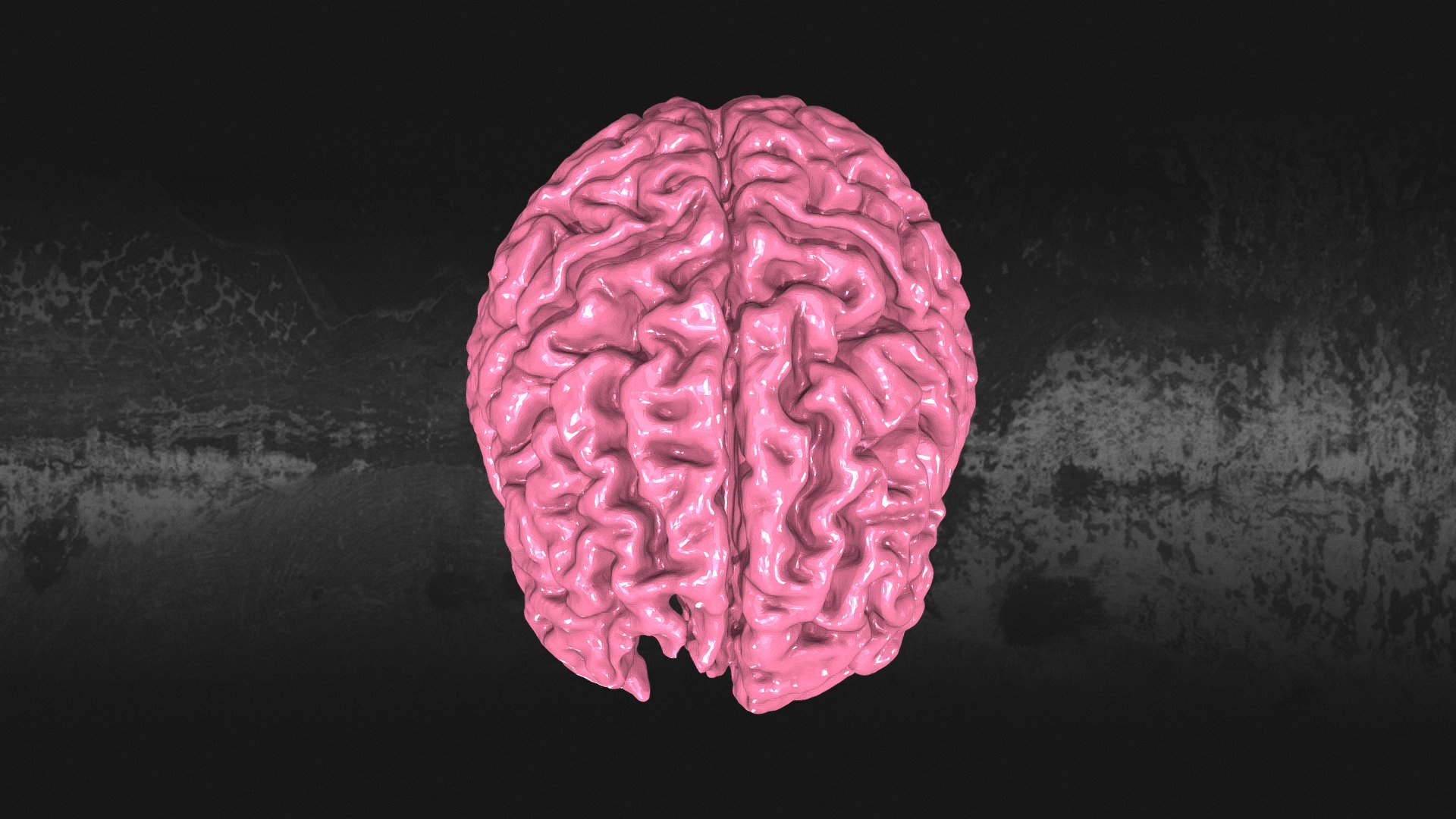 Injured 3D Printed Brain Model