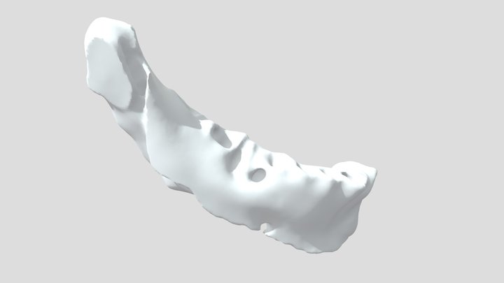 Bespoke mandibular implant 3D Model