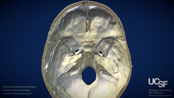 Pterional- Model 2 – Free 3D Model STL