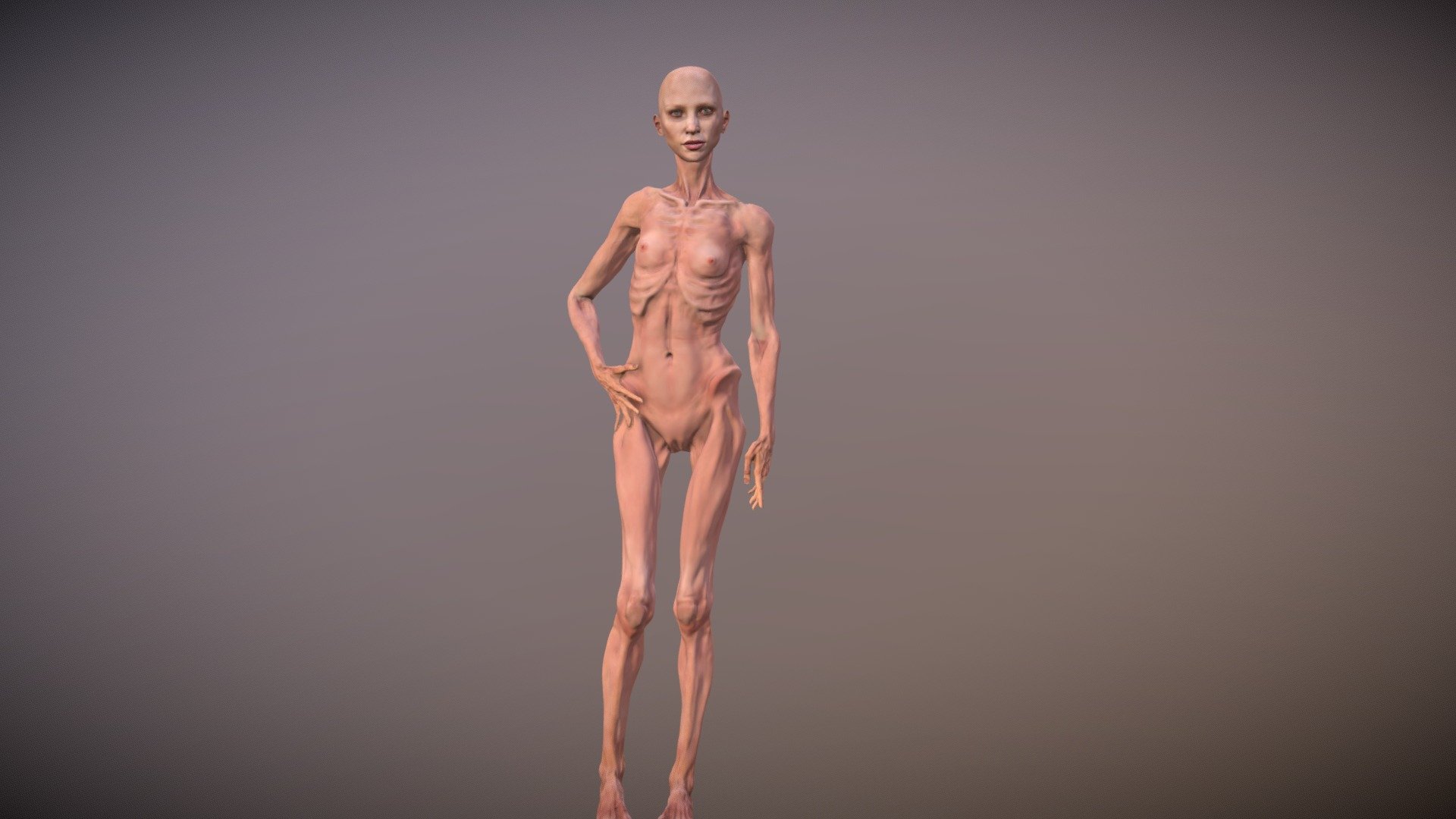 Anorexic Nude Pics