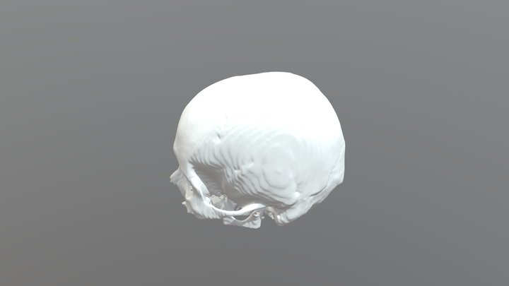 3D SR File 3D Model