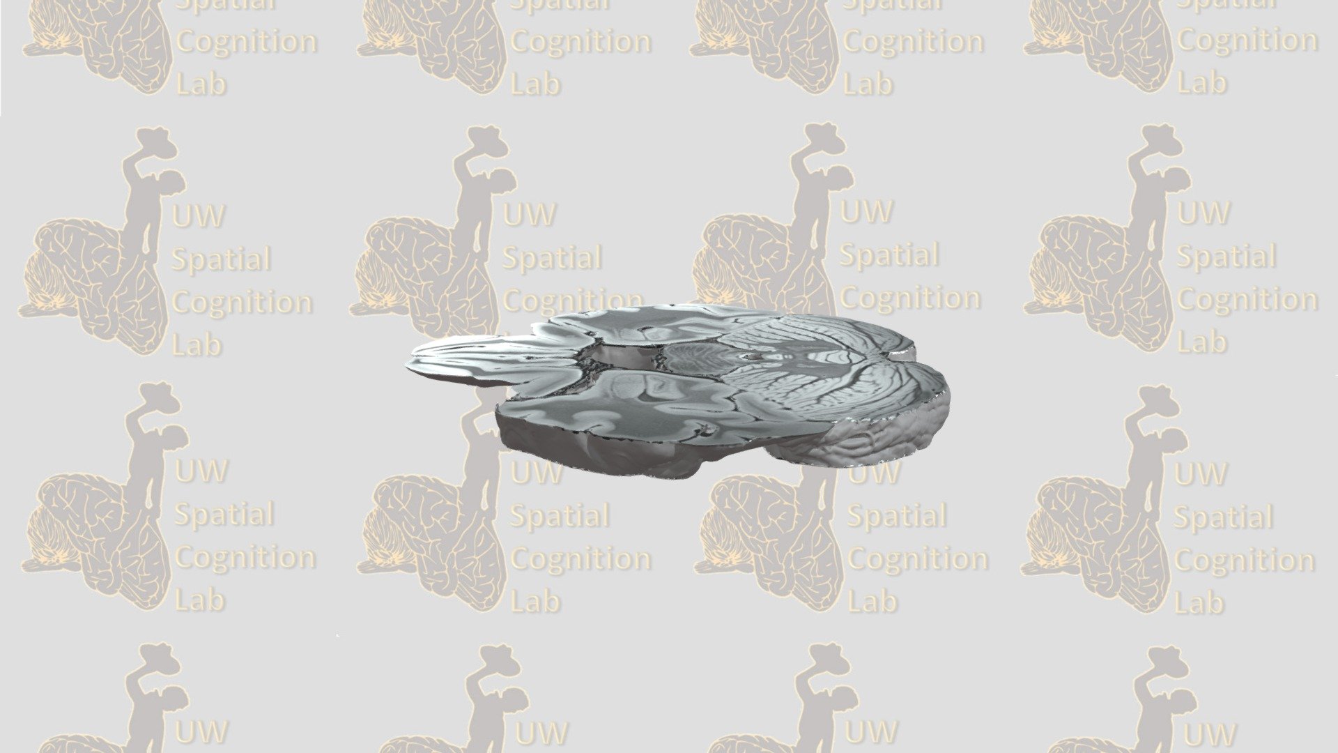Axial Slice 11