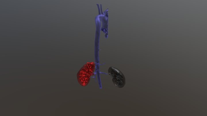 Aorta_Kidneys 3D Model