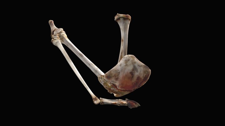 leg_malformation 3D Model