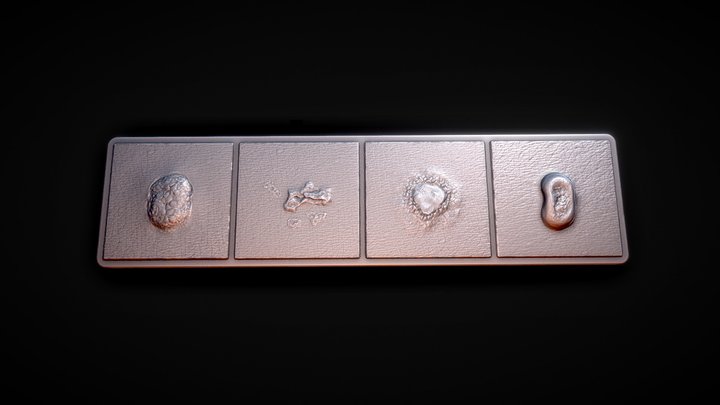 TIRA LESIONES - SUPERFICIE 3D Model