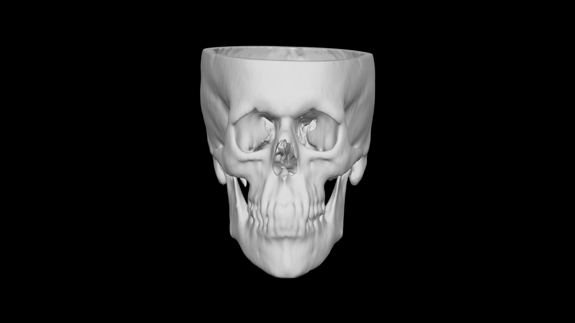 Skull Male 55yo