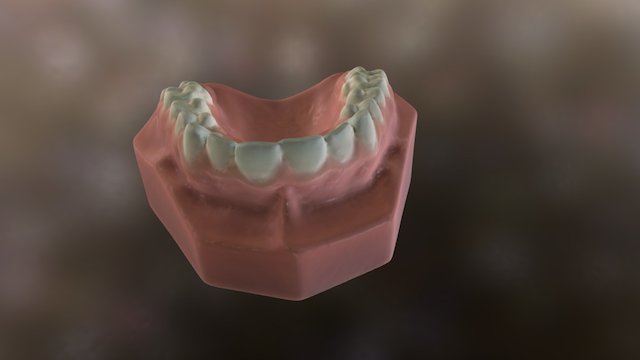 300070 Lower Teeth Orthodontic Model 3D Model