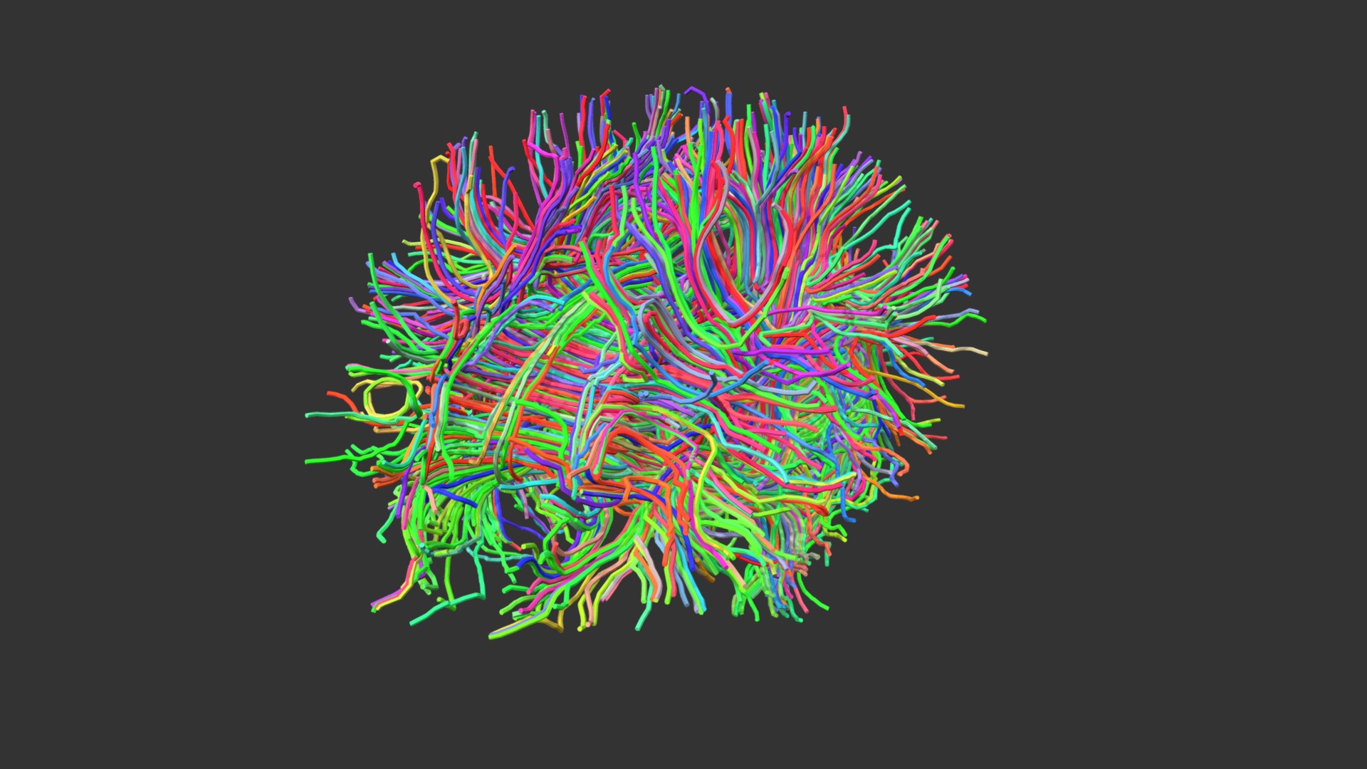 3D model Brain Fibre Tracts from an fMRI scan - This is a 3D model of the Brain Fibre Tracts from an fMRI scan. The 3D model is about a colorful design on a black background.