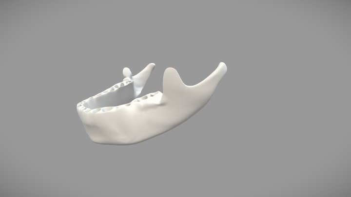 下颌牵引器 3D Model