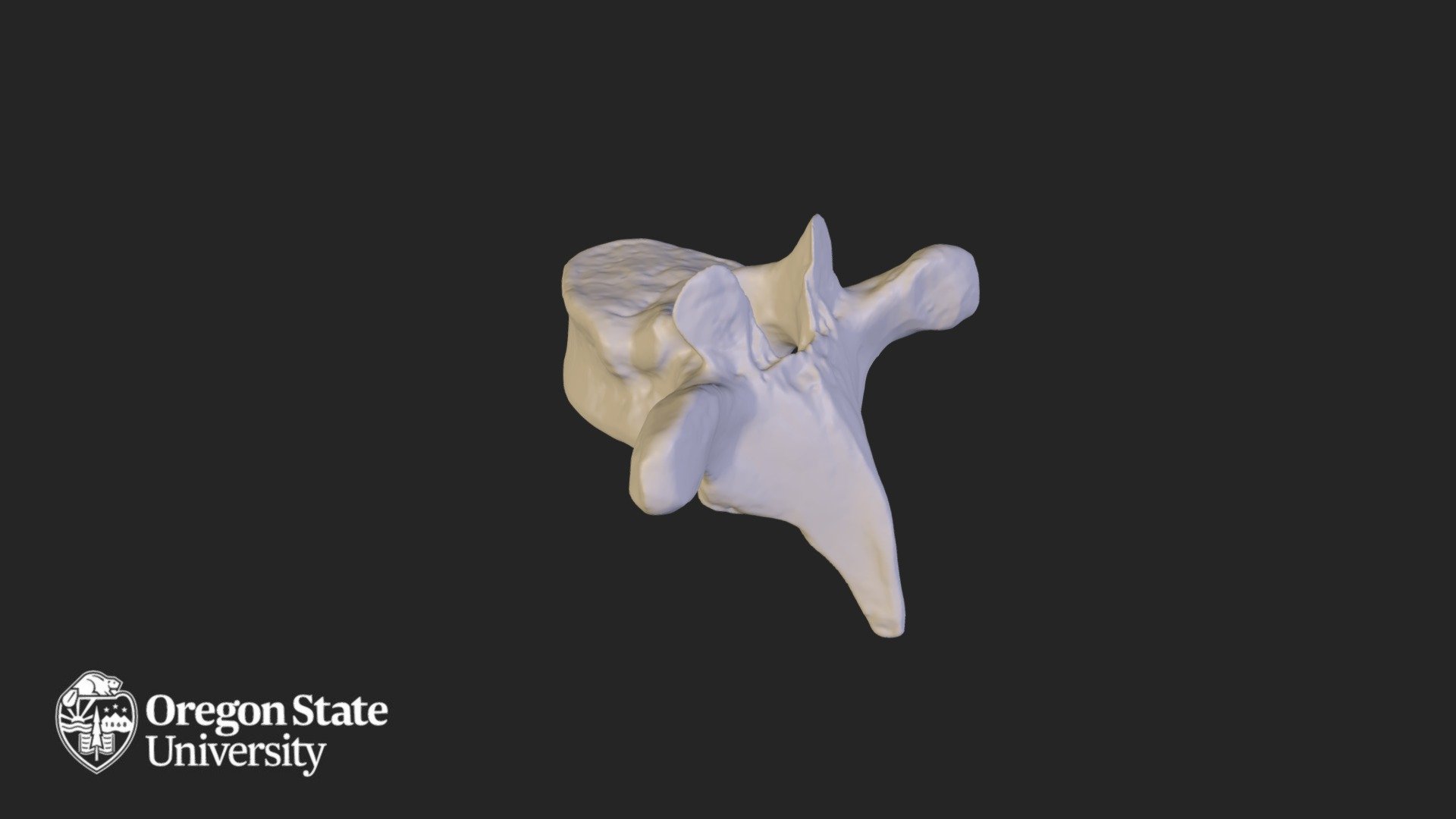 Thoracic vertebra - T6