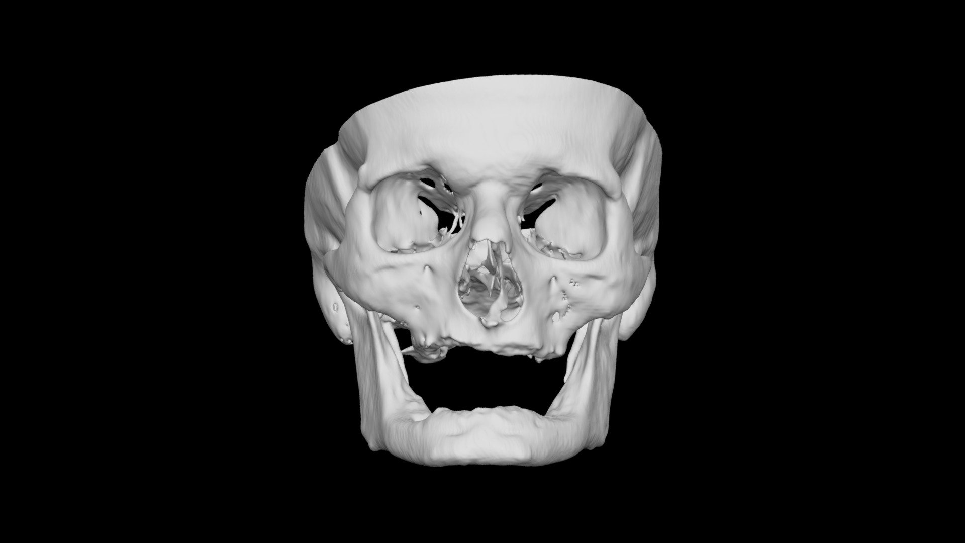 Skull Male 58yo