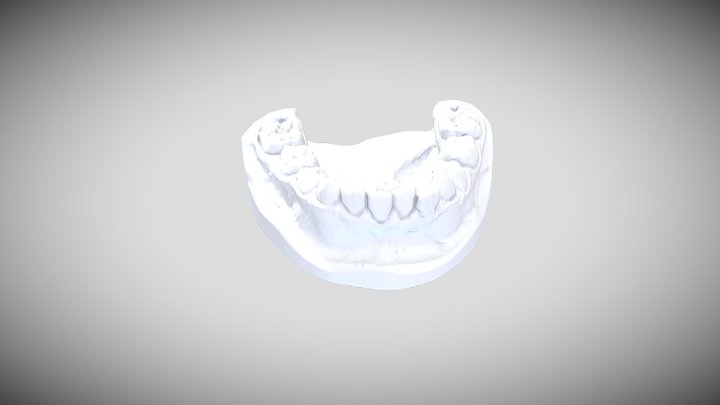 Model diagnostyczny ortodontyczny (żuchwa) 3D Model