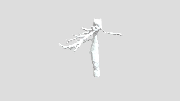 301 Abdomen C0_625mmP segmentation_inferior vena 3D Model