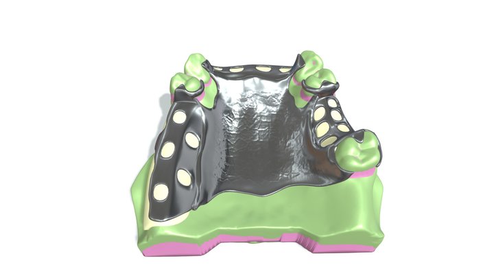 Metal frame denture 3D Model