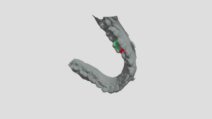 Cavity Preparation 3D Model