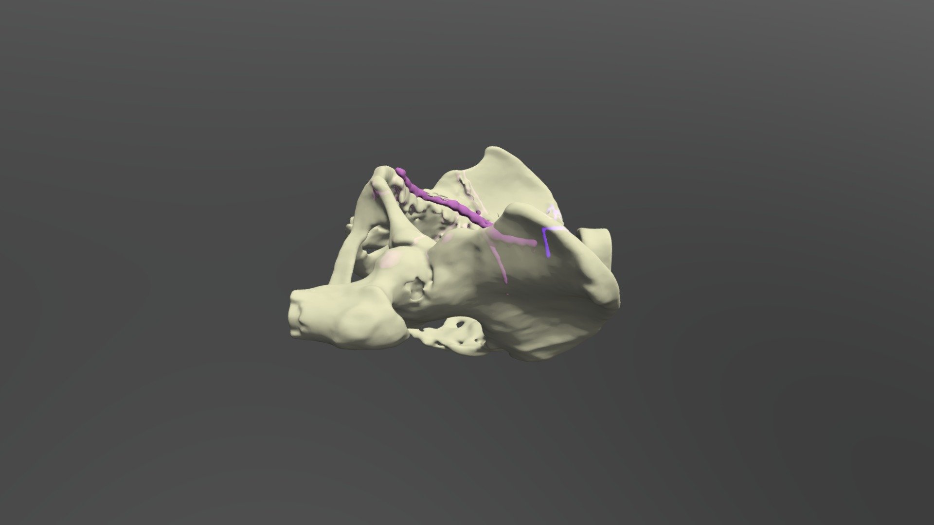 Pelvis