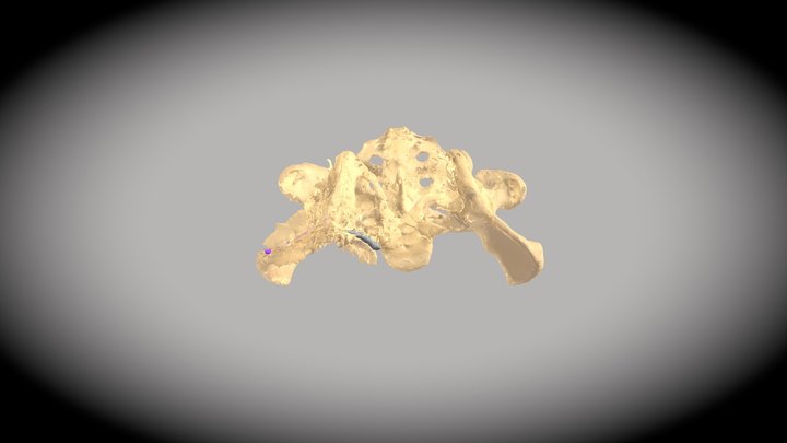 Lins_ Segmentation 3D Model