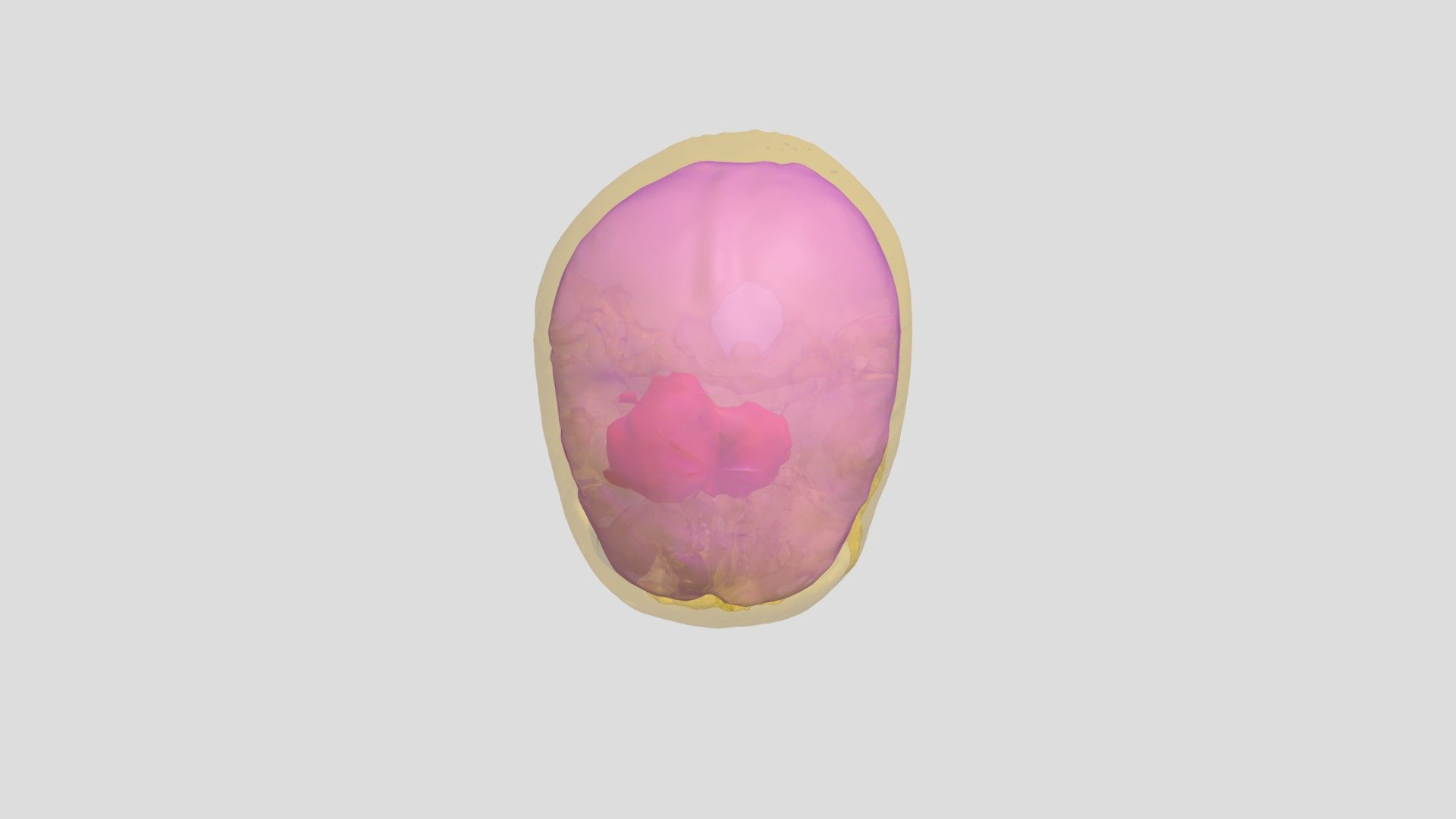 CT_MRI_Brain_Tumor_Segmentation