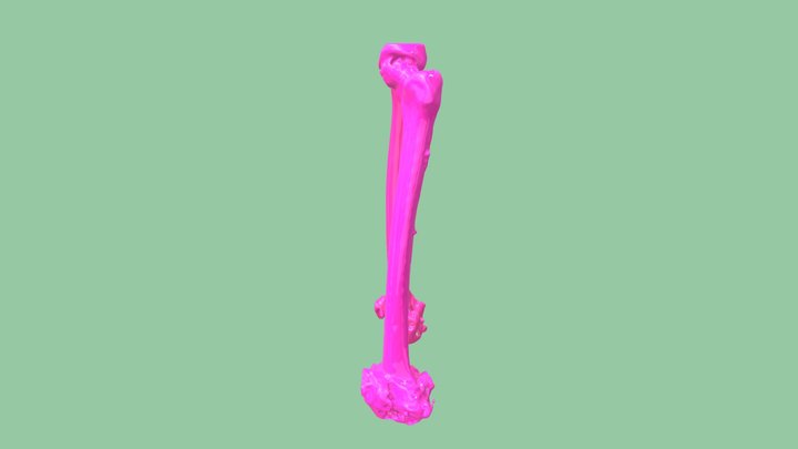 Femurs 3D Model