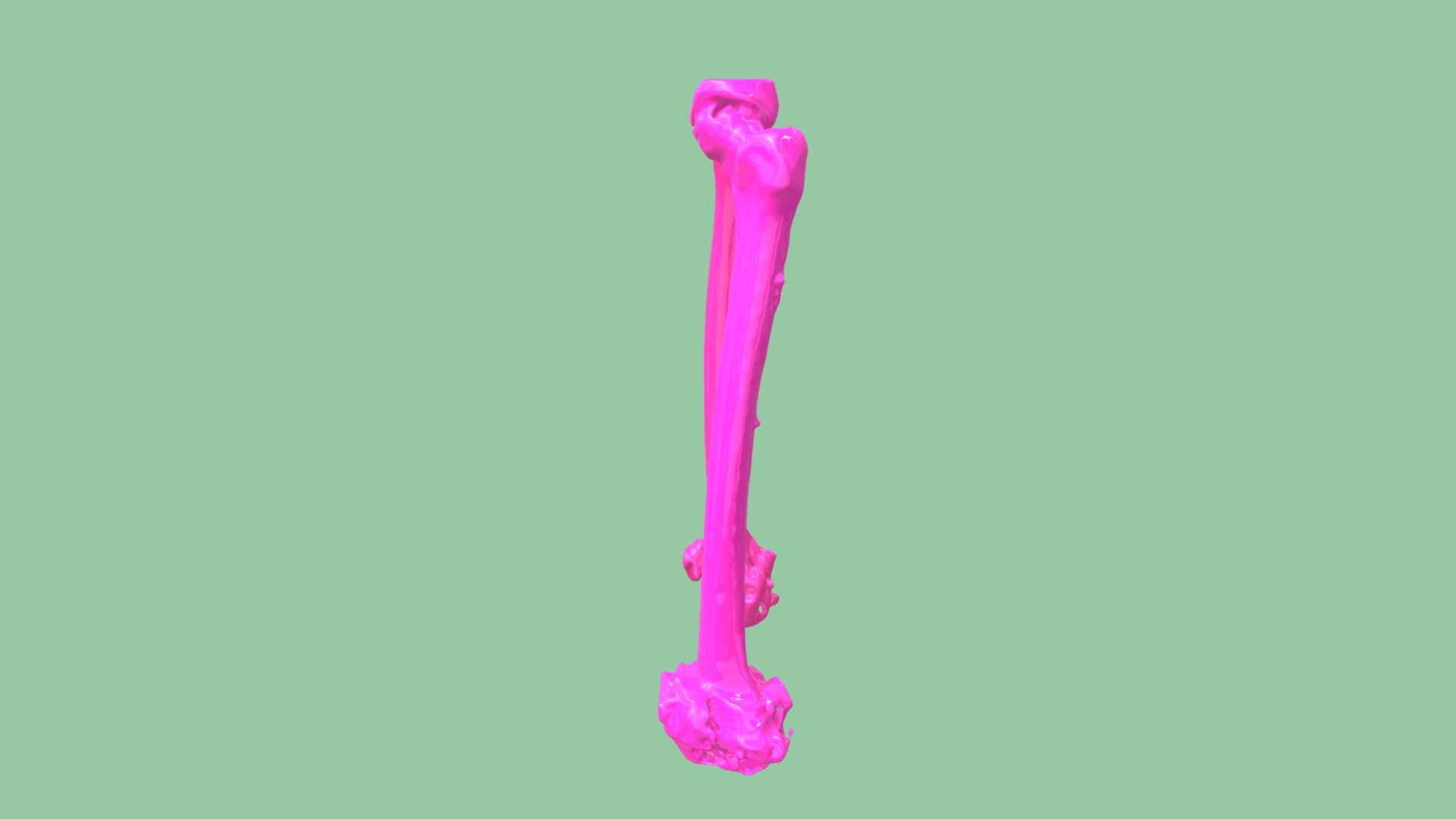 Femurs