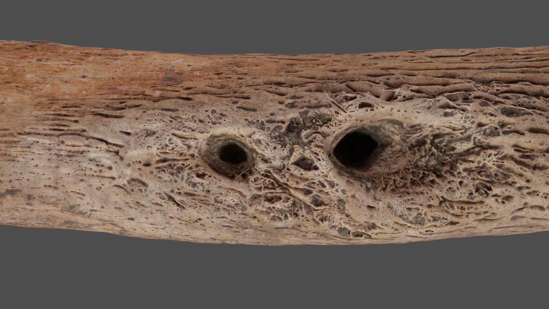 tibia