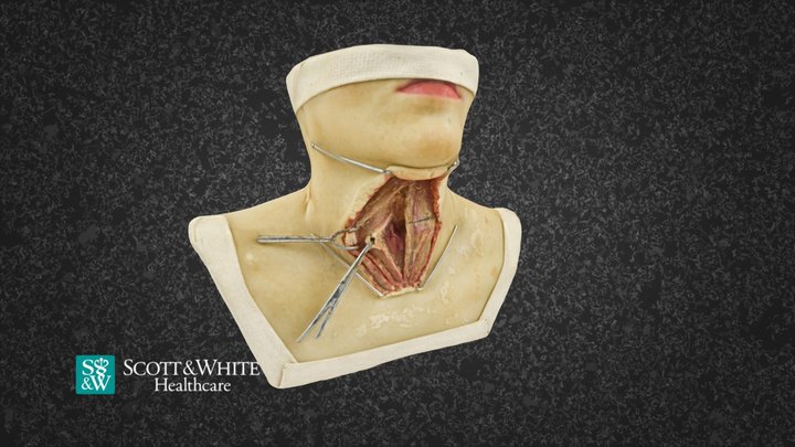 Thyroidectomy Surgery - 02 3D Model