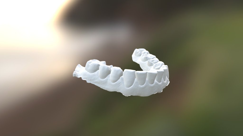 Joao Lower Jaw