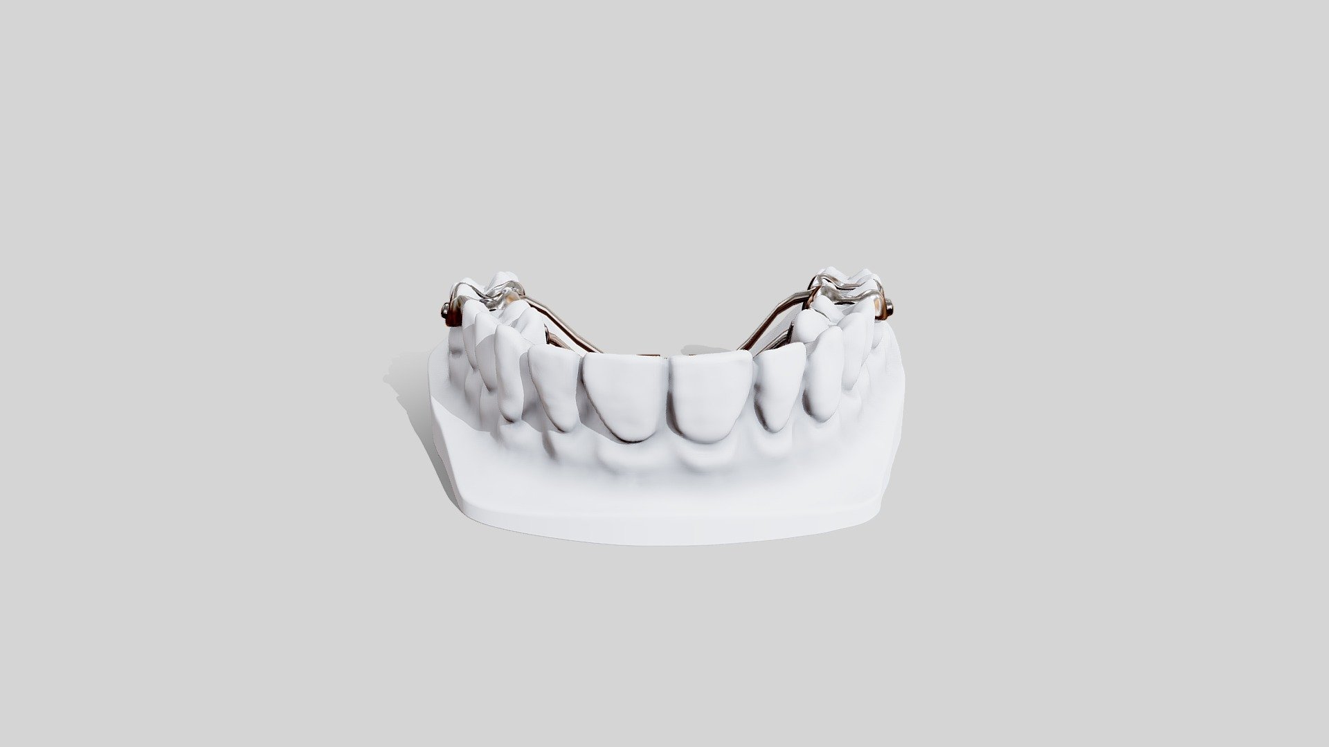 3D_Leaf_Spring_Activated_Expander_01 - 3D model by TheBranclem [a9b480c ...