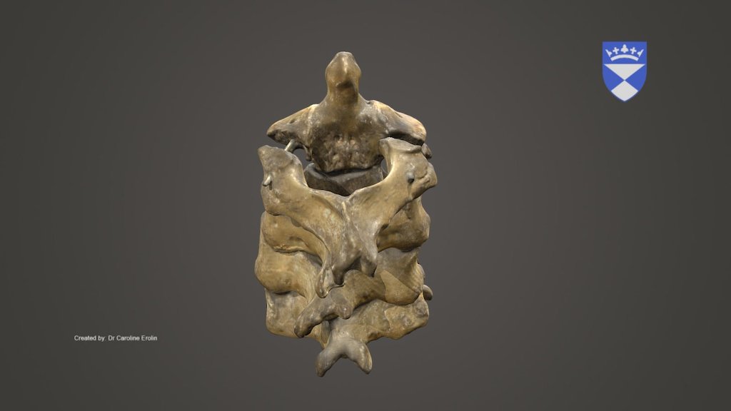 vertebrae original texture - 3D model by University of Dundee, CAHID ...