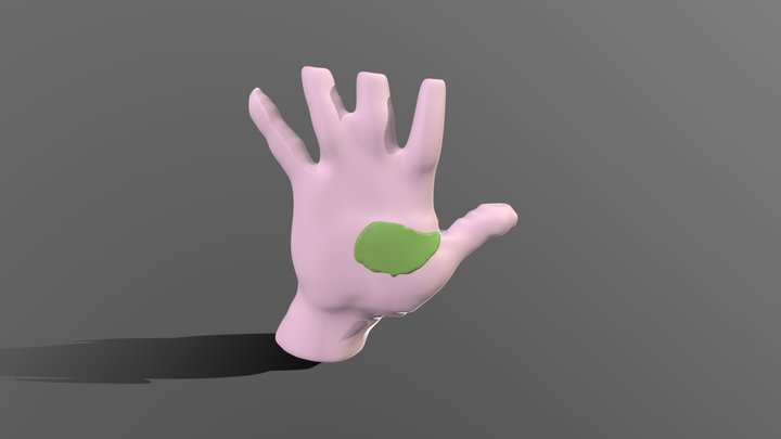 ManoPielTumorSuperficie 3D Model
