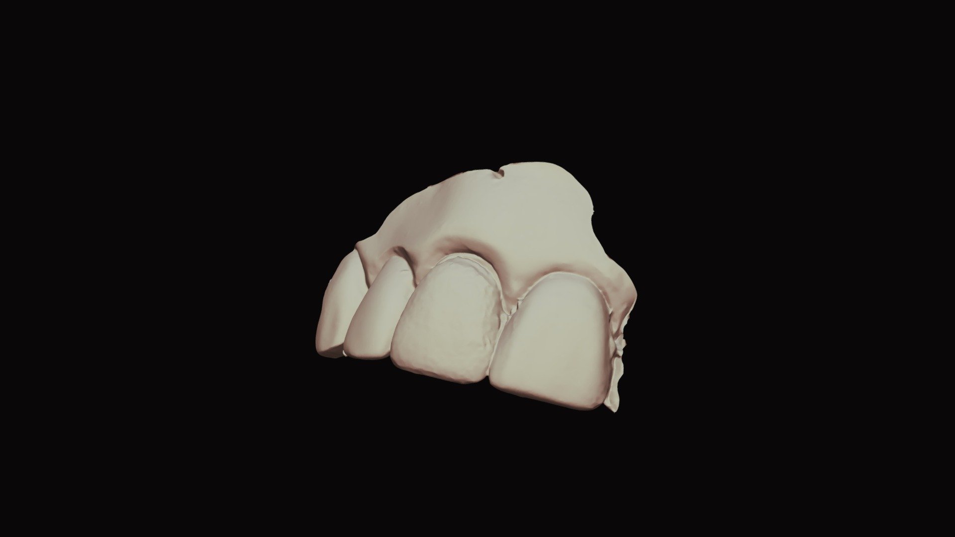 8, Group 4, Dayna T_UpperJaw