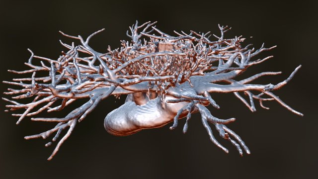 3D Fractal