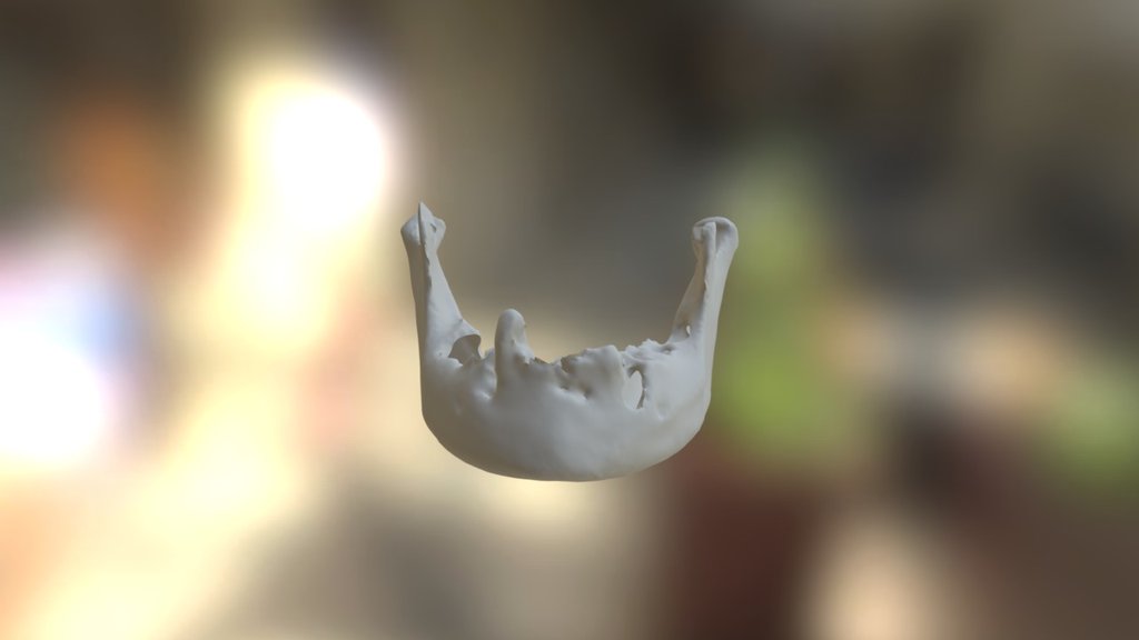 UWF2 Mandible - Periodontal Disease