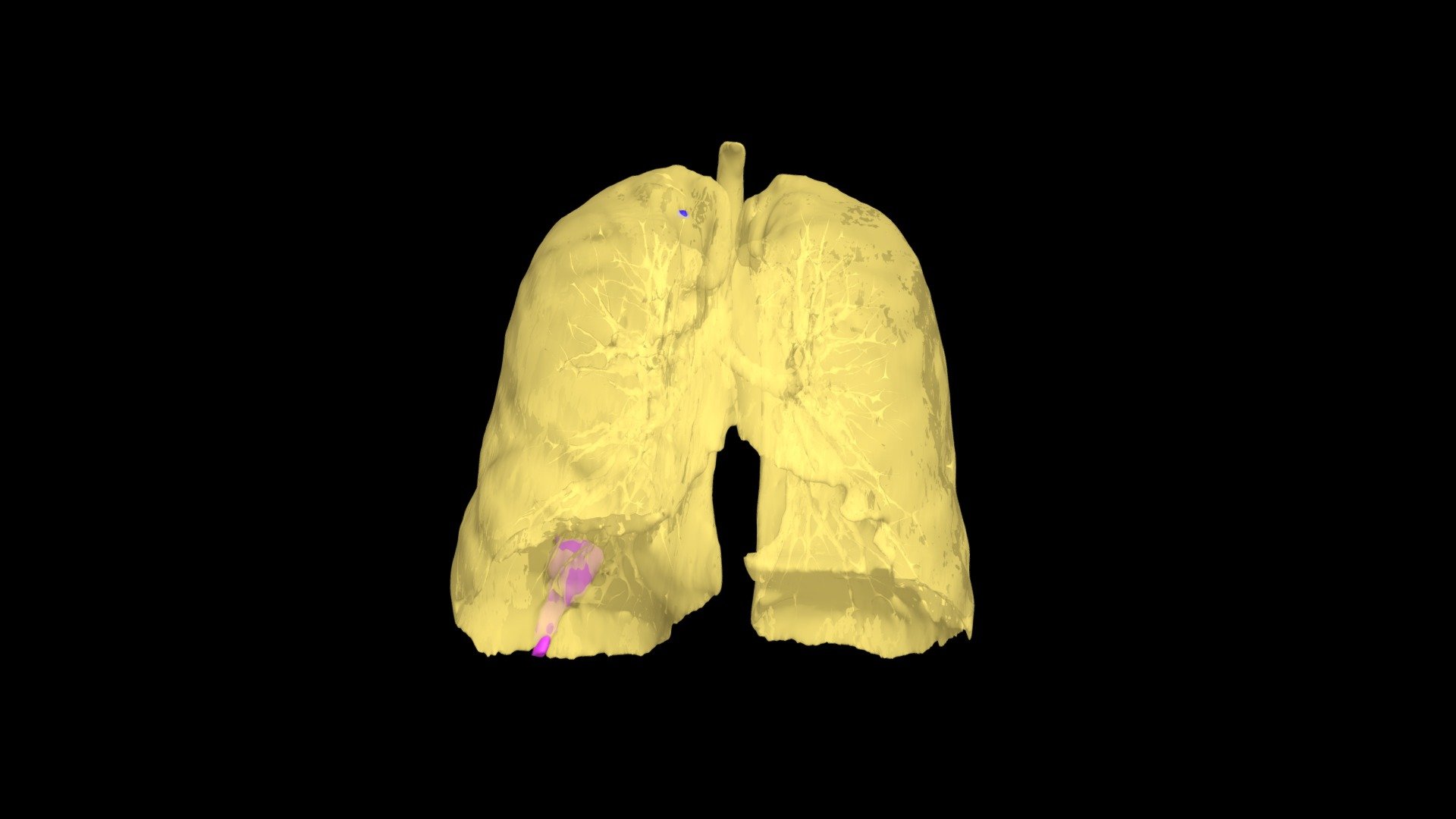 NSCLC Model 267