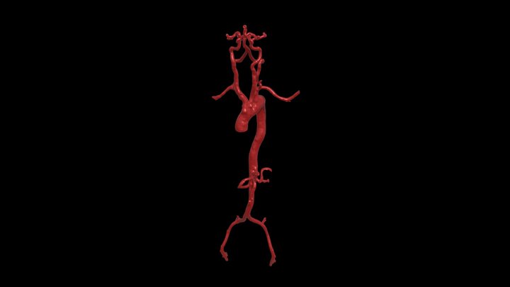Aorta y Polígono de Willis 3D Model