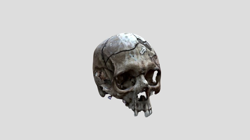 CRANIO BALEADO