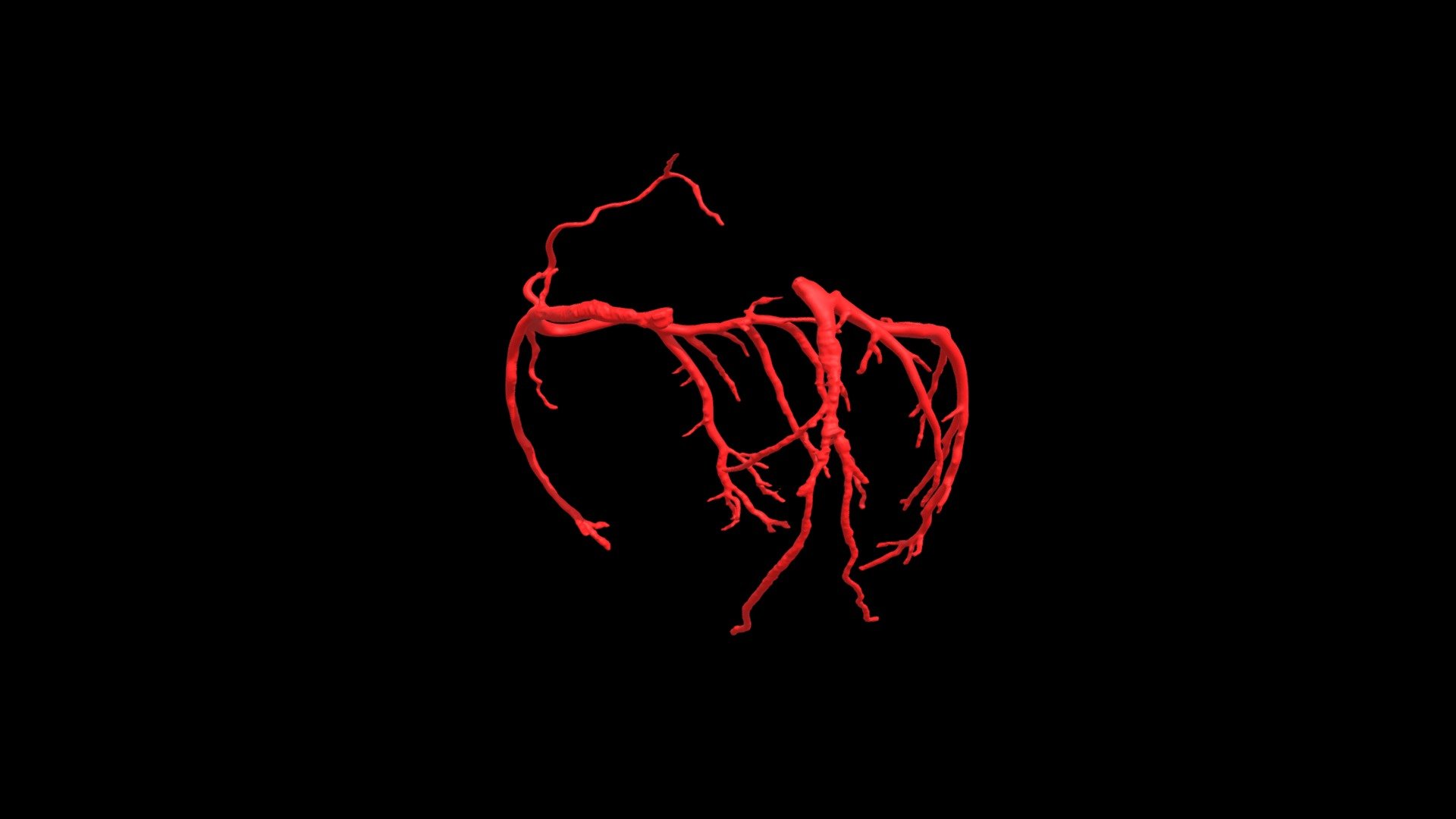 Heart0088 Coronary Arteries - Download Free 3D model by ...