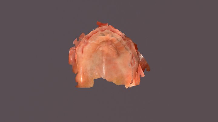Maxillary digital impression 3D Model