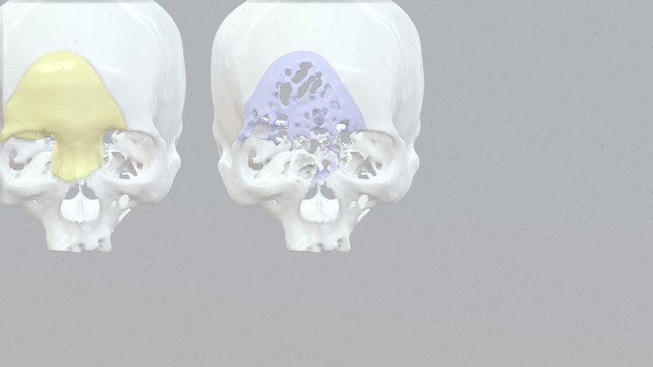 20260203-01 3D Model