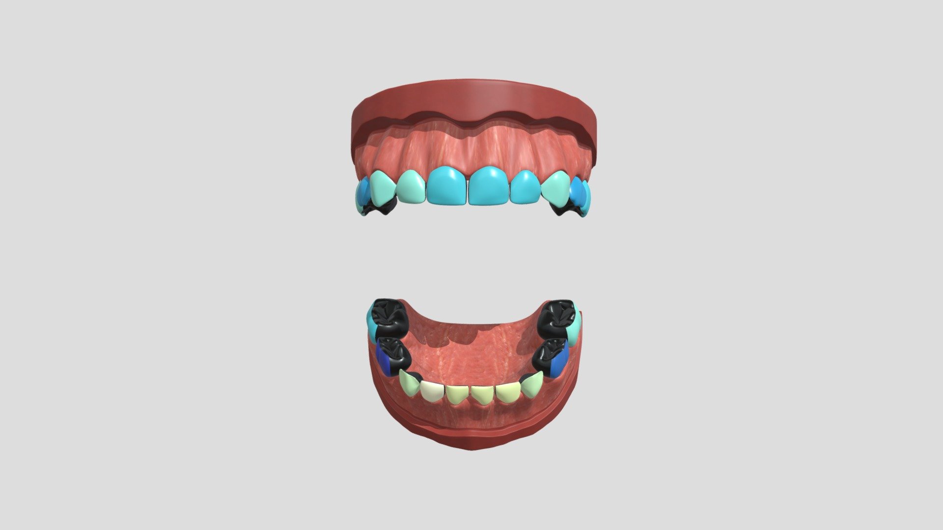 diff_nzunrestored_4cm_4c