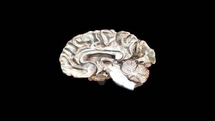 Thalamic Fasciculus 3D Model
