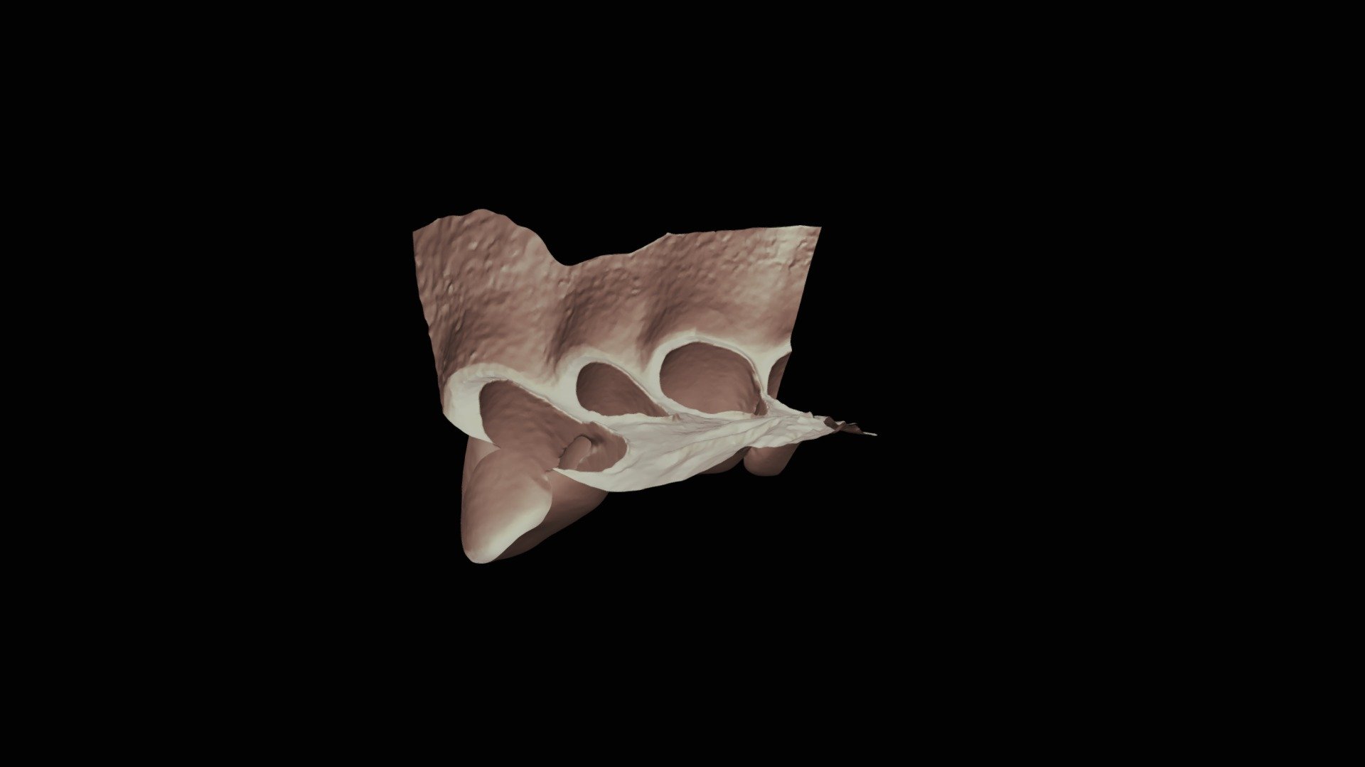 #9 Group 6 Class 3 Upper Jaw