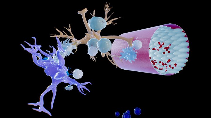Multiple Sclerosis Model 3D Model
