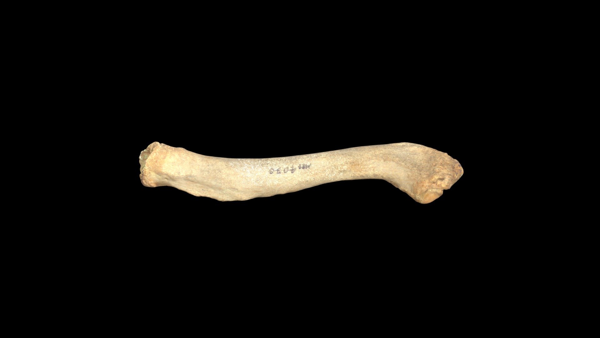 L. Clavicle with Stress Marker (VCU_3D_3970)