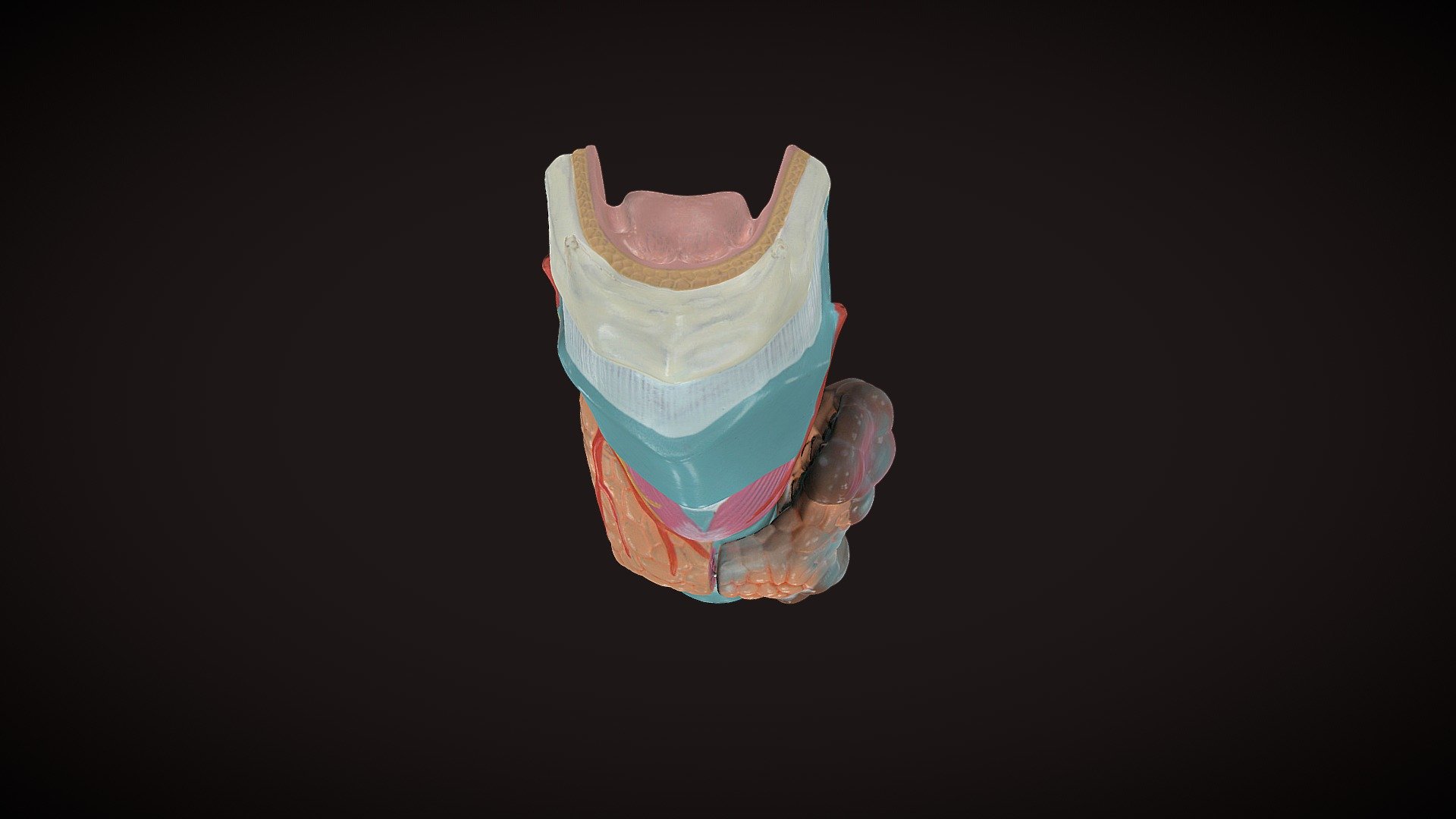 Thyroid Gland With Cancer - 3D model by OrJames Labs (@orjameslabs ...