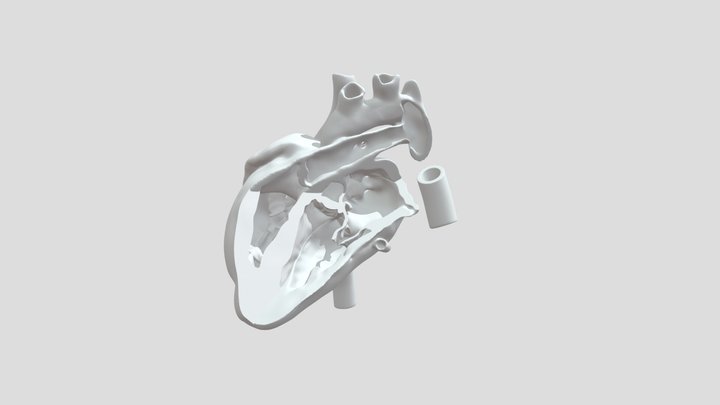 Fetal Heart Outflow Tracts 3D Model