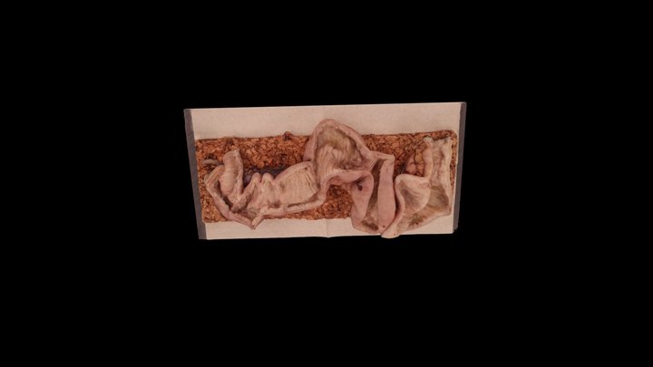 Bowel 1b 3D Model